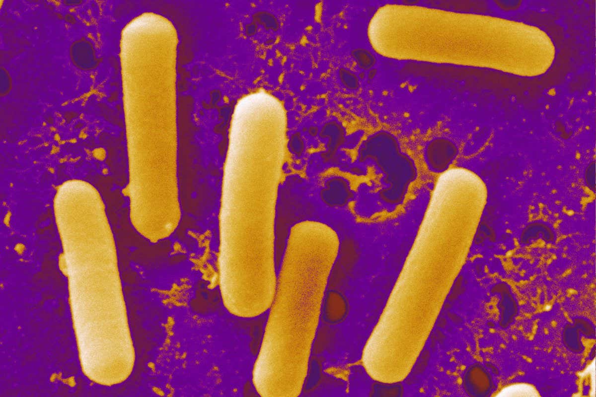Scanning electron micrograph of Lactobacillus reuteri. Lactobacillus reuteri, a probiotic bacterium