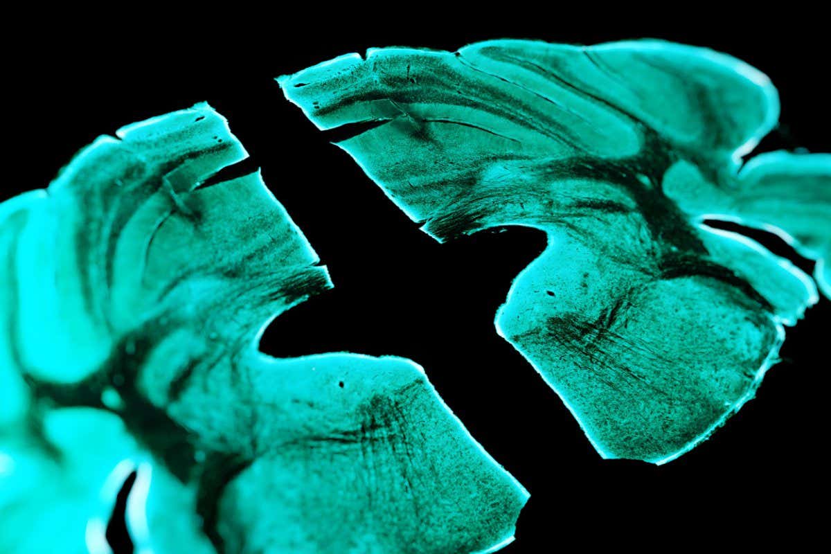 A section of a mouse brain viewed on a slide