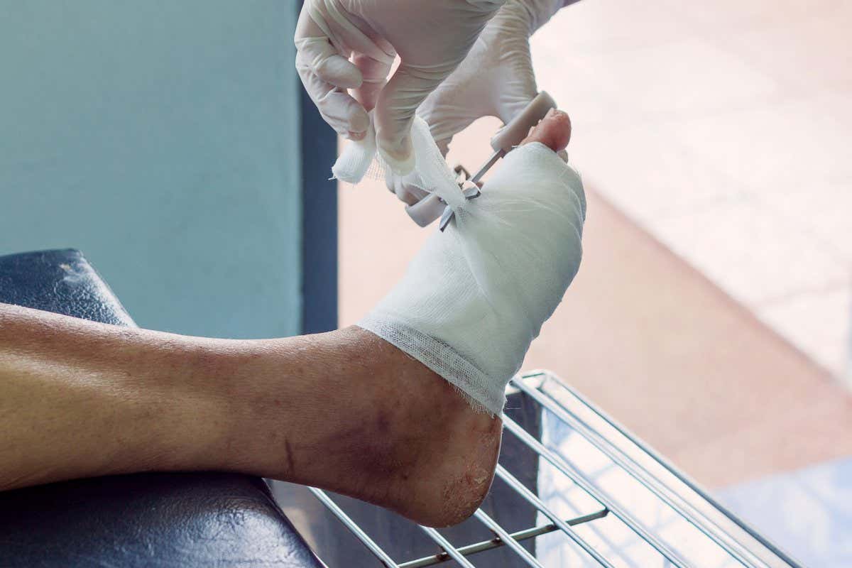 bandaged wound on a foot