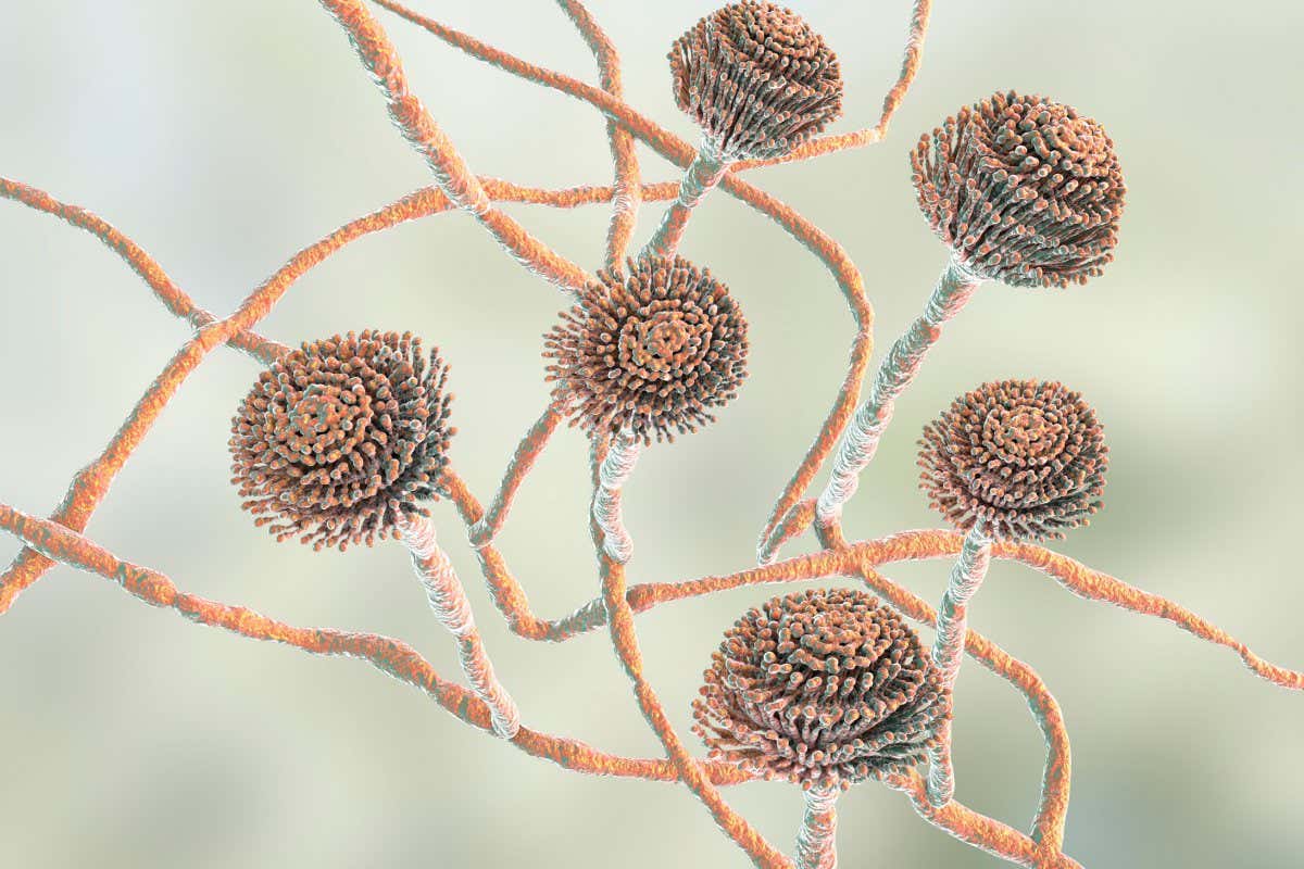 Image of Aspergillus, a black mould that can cause pulmonary infection