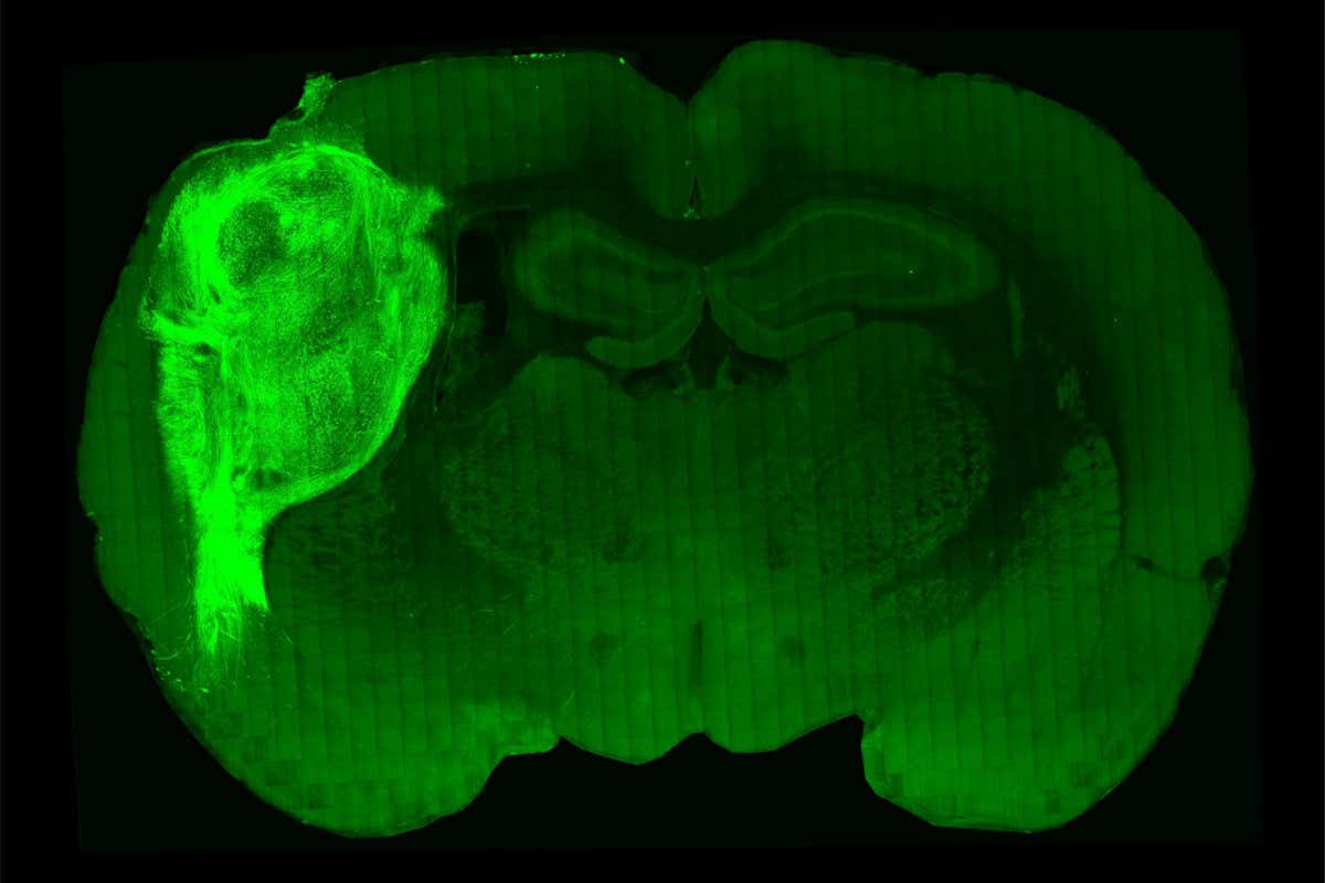 A transplanted human organoid labeled with a fluorescent protein in a section of the rat brain. Credit: Stanford University.