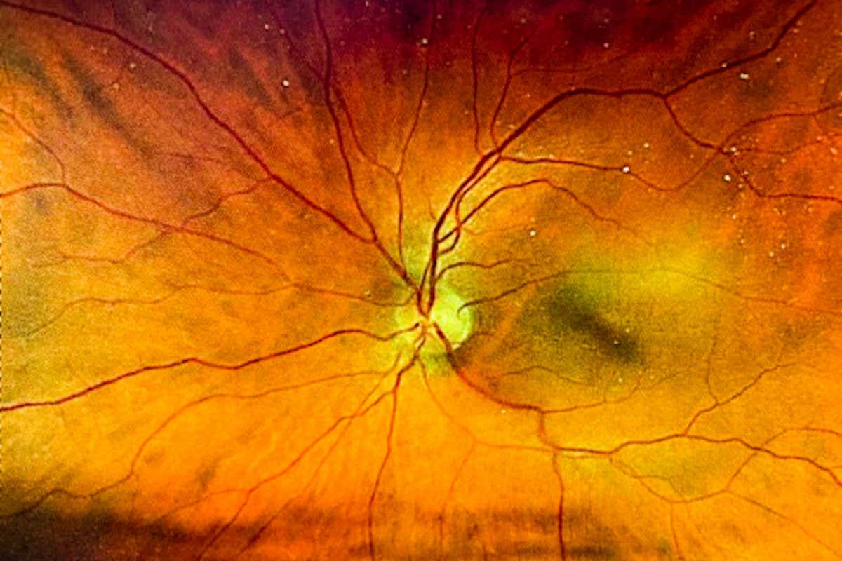 An image of a human retina taken during an eye exam