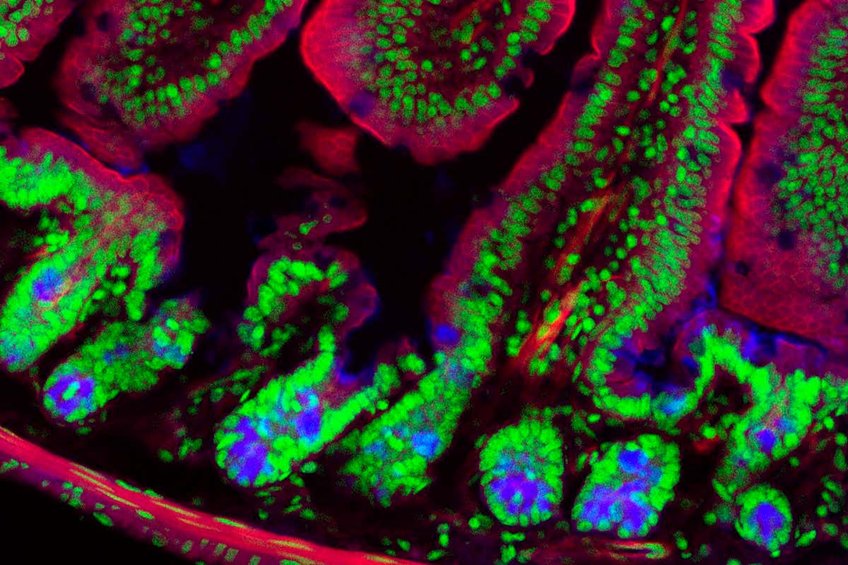 Pain that affects the gut lining of mice may have some protective properties