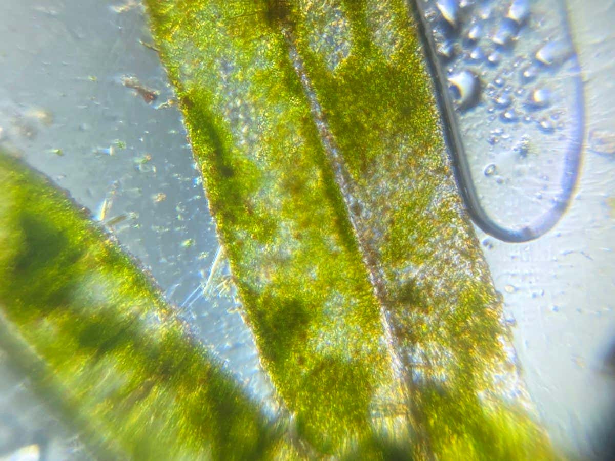 Study your local pond to help track algal growth around the world