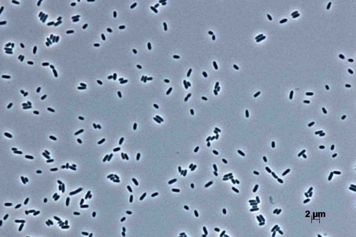 The bacterium Hafnia alvei produces a molecule that mimics an appetite-reducing hormone