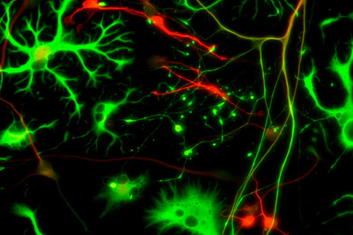 Nerve cells. Fluorescent light micrograph of neurons (nerve cells, red) and glial cells (support cells, green). The glial cells have been stained to show glial-fibrillary acidic protein, a type of intermediate filament (IF). The neurons have been stained to show beta-tubulin, a protein that makes up microtubules. Neurons are responsible for passing information around the central nervous system (CNS) and from the CNS to the rest of the body. Each neuron comprises a cell body surrounded by numerous extensions called dendrites. Dendrites collect information from other neurons or from sensory cells. Each neuron also has one process called an axon, which passes information to other neurons, or to effector cells such as muscle fibres. Glial cells provide structural support for neurons and supply them with nutrients and oxygen.