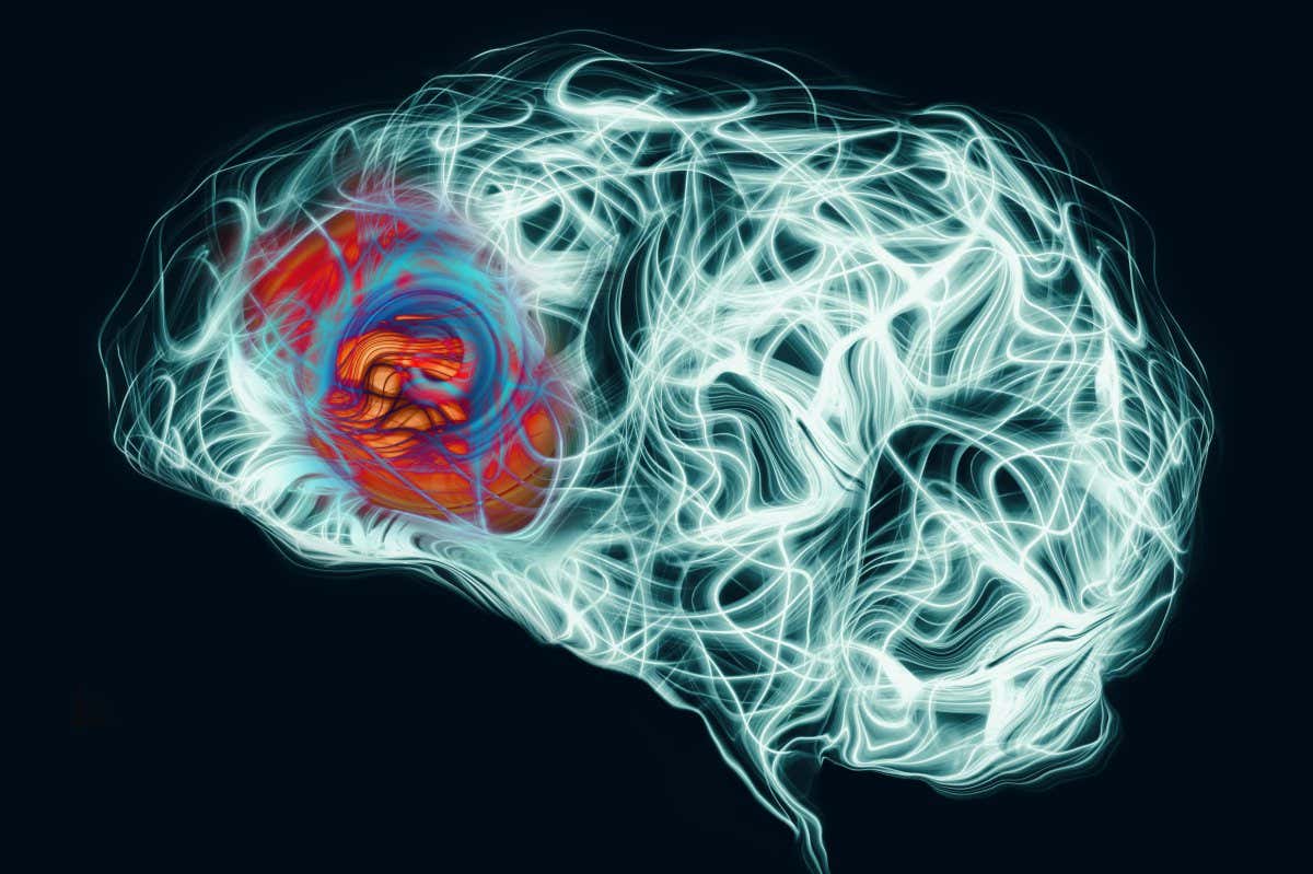 Light wave pattern of human brain with area of pain
