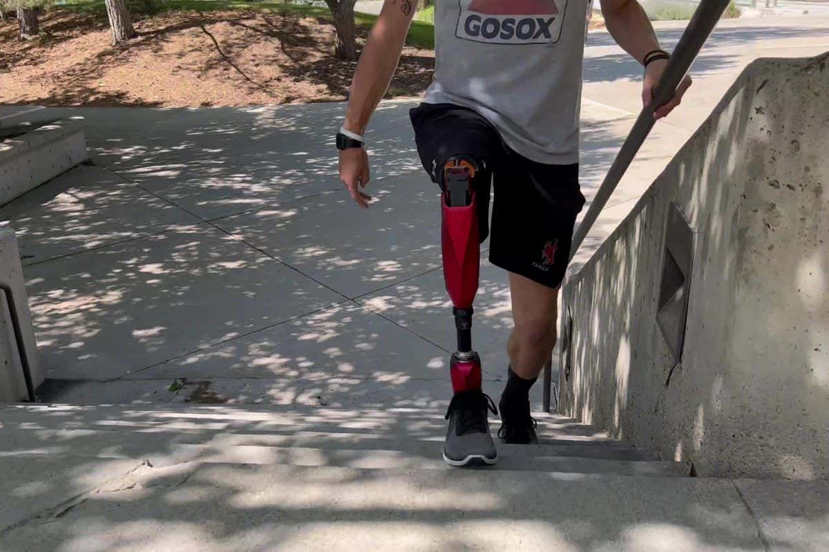 Photos of an amputee subject using the powered leg