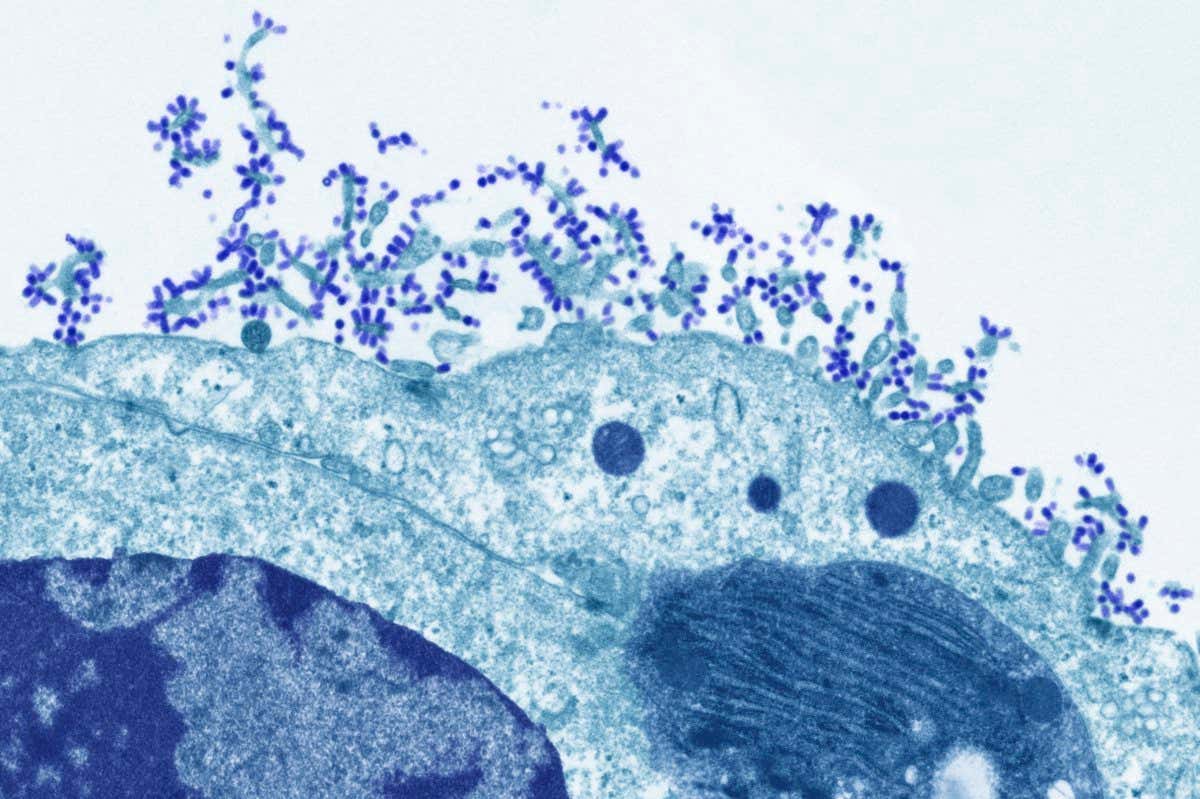 Human cells infected with influenza virus