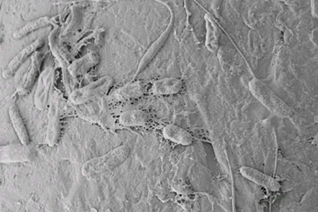 Bacteria seen with an electron microscope