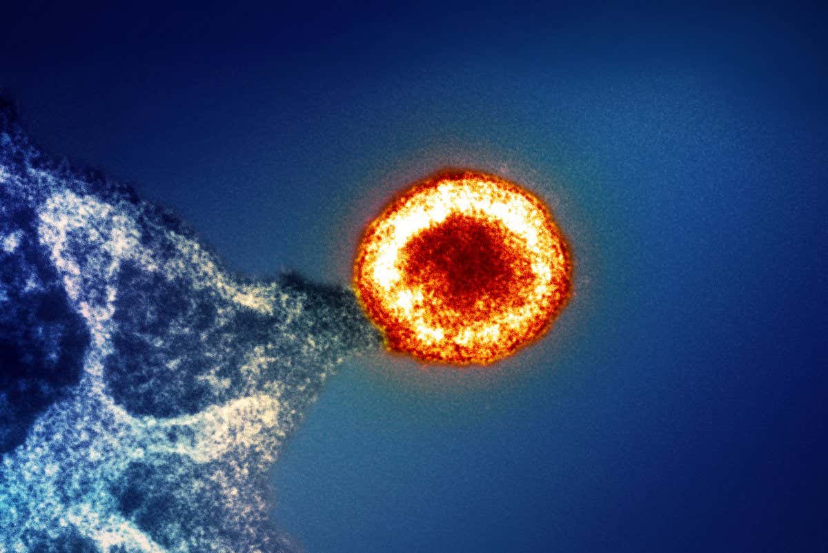 An electron micrograph of an HIV virus particle (red/yellow) budding from the plasma membrane of an infected T cell (blue), which make up part of the immune system