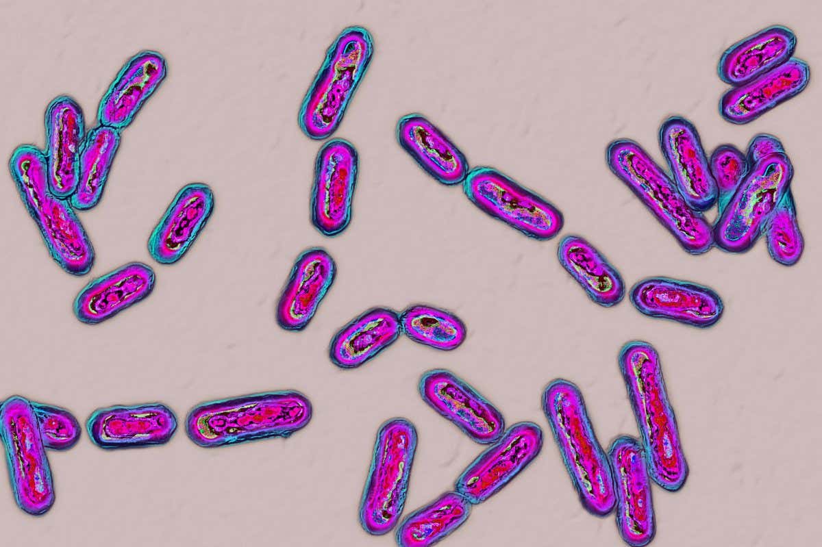 H78XNF CLOSTRIDIUM DIFFICILE