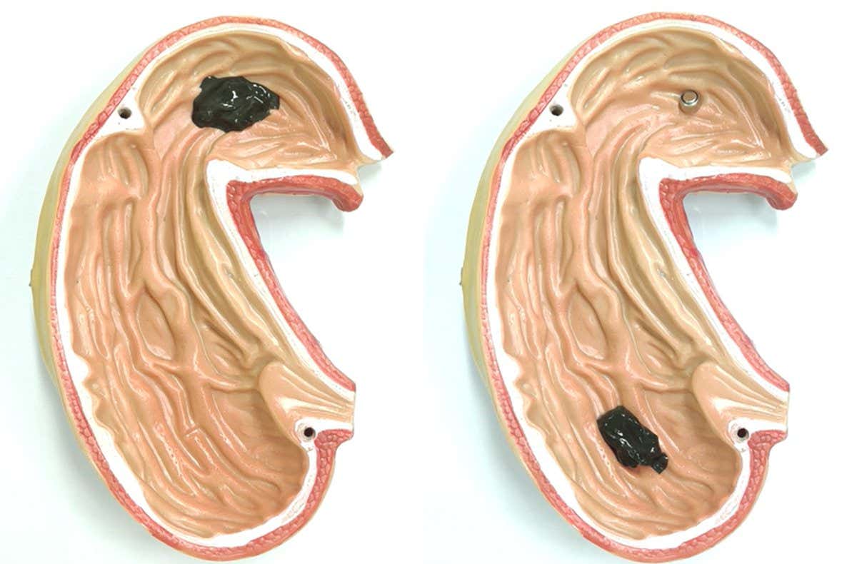 Slime robot inside a model of the stomach