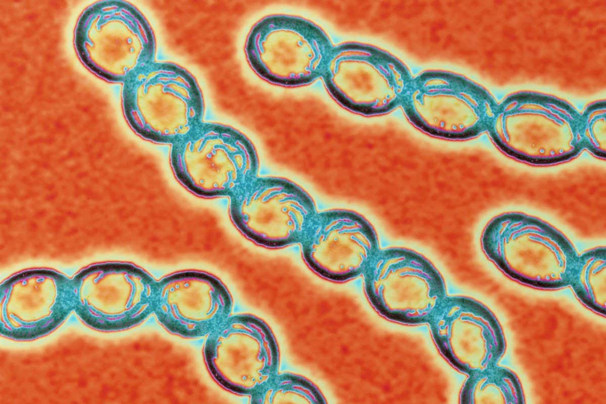 A transmission electron micrograph of Streptococcus pyogenes