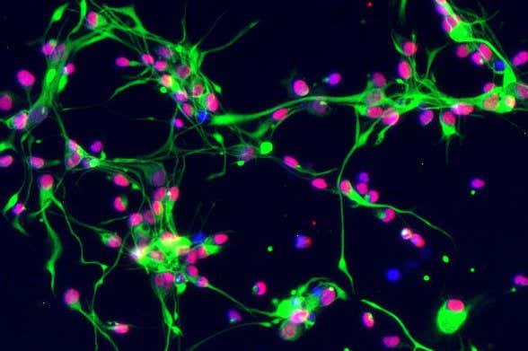 Human neural stem cells captured via a fluorescence light micrograph