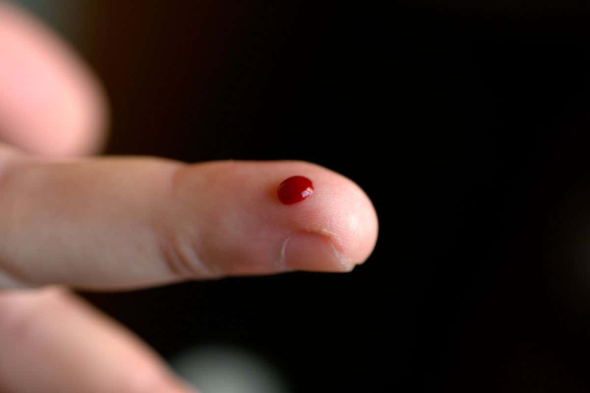 AR4J5D Drop of blood suspended on one finger after prick for diabetic test