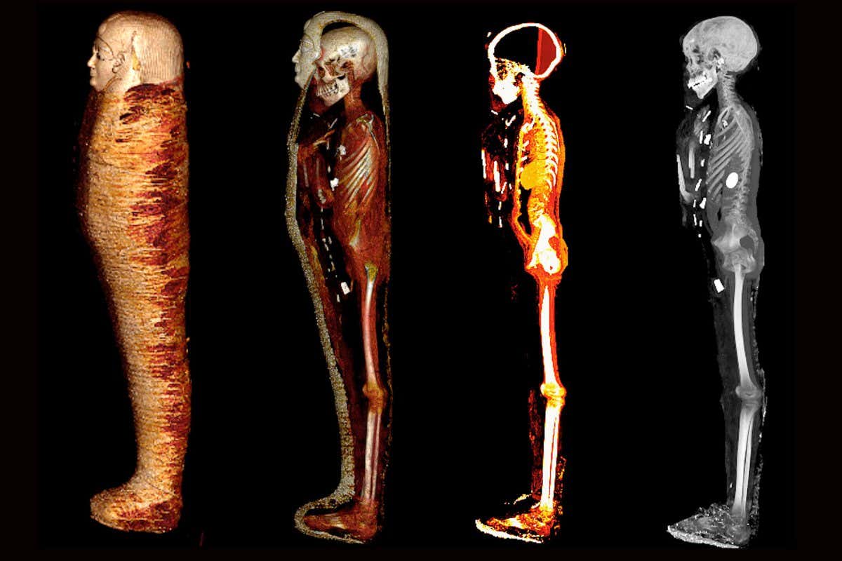 The mummy of a boy digitally unwrapped in four stages