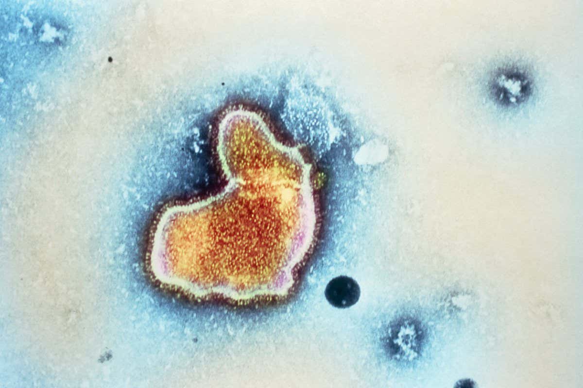 The respiratory syncytial virus (RSV) usually causes mild, cold-like symptoms, but can be severe in vulnerable people