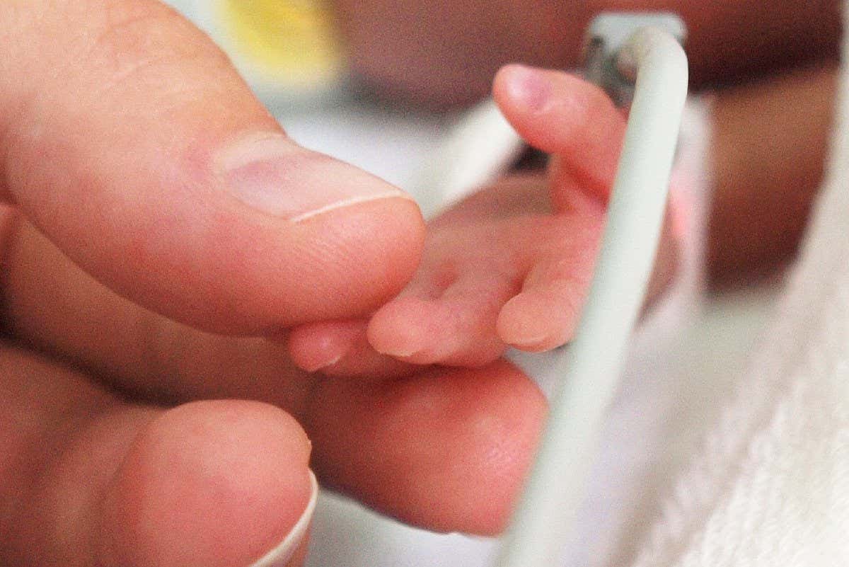 The tiny hand of a preterm baby