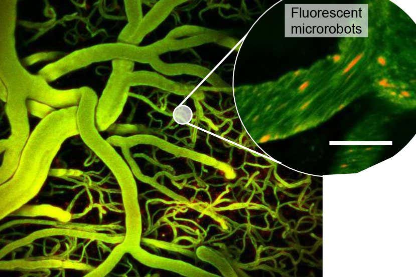 Image of blood vessels in a mouse brain with an the inset picture showing fluorescent microbubbles that have been directed with ultrasound