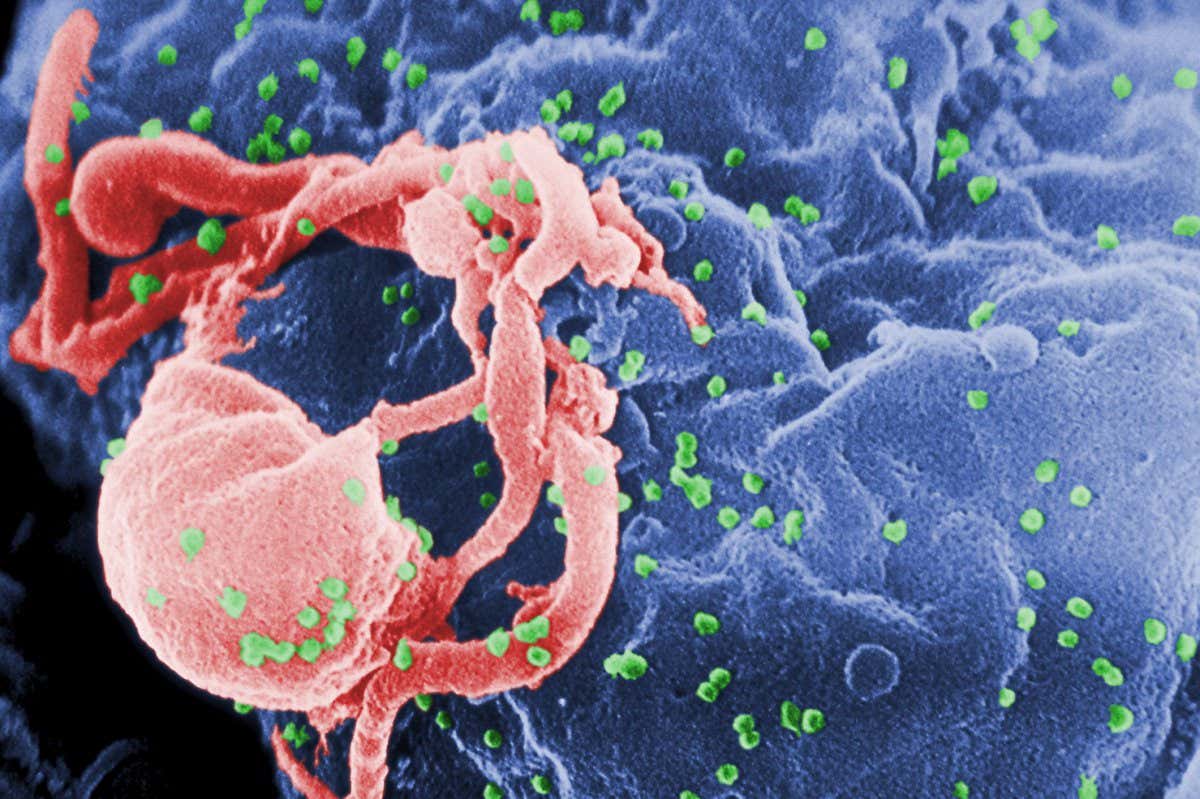 HIV (green) infecting an immune cell