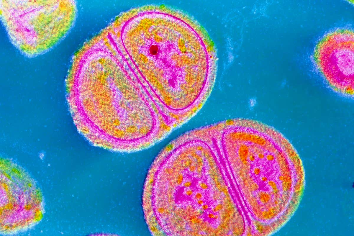 A transmission electron micrograph of Staphylococcus epidermidis, one of two bacteria associated with a loss of collagen in older women