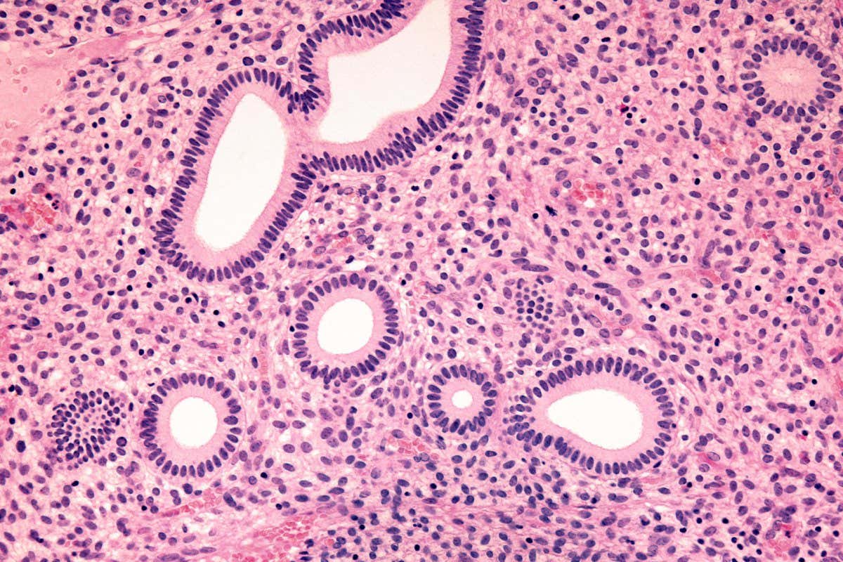Human endometrium tissue, which lines the uterus, from a person without endometriosis