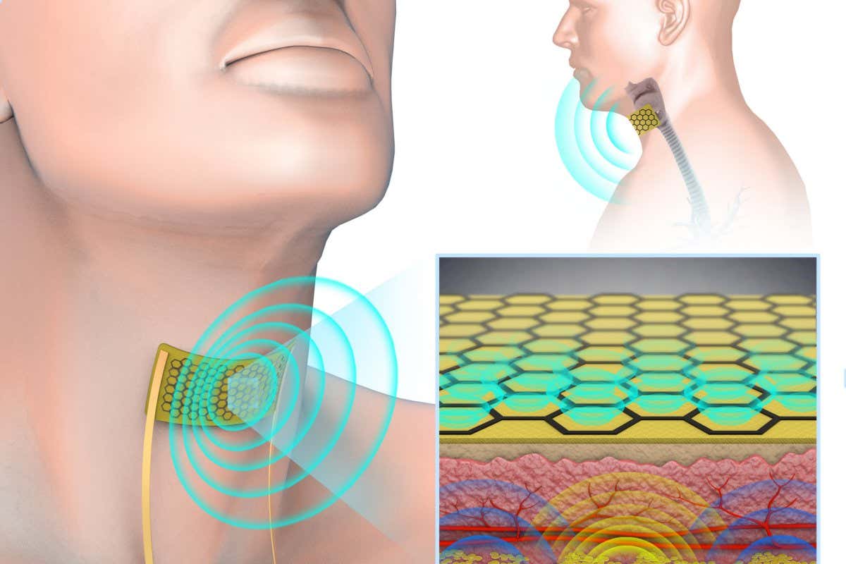 A throat patch that can detect silent speech and act as a speaker