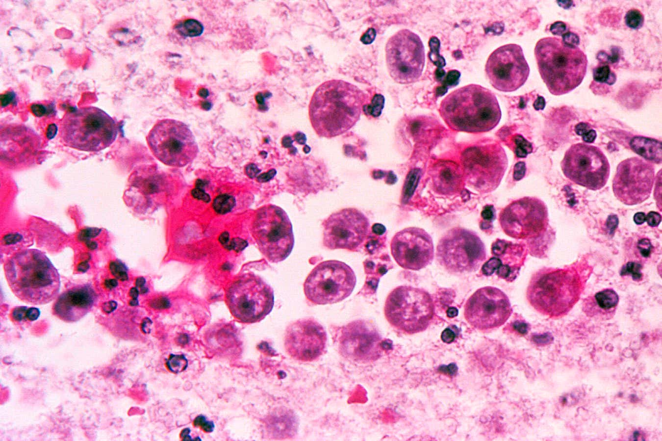 Naegleria fowleri amoeba