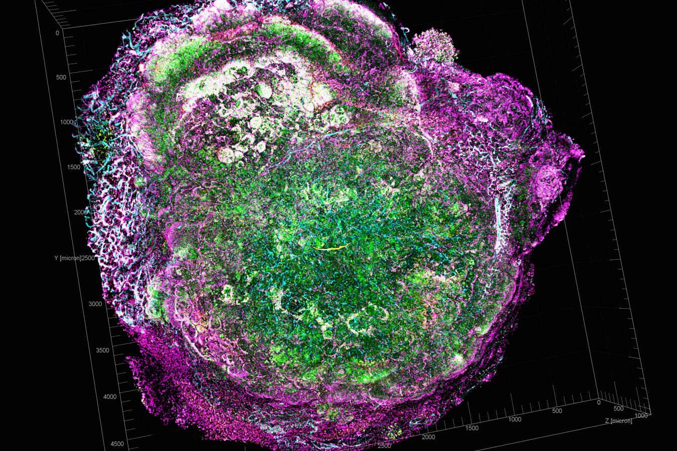 Transparent tumour tomography visualising tumour microenvironment, showing a mouse model for HER2-positive breast cancer