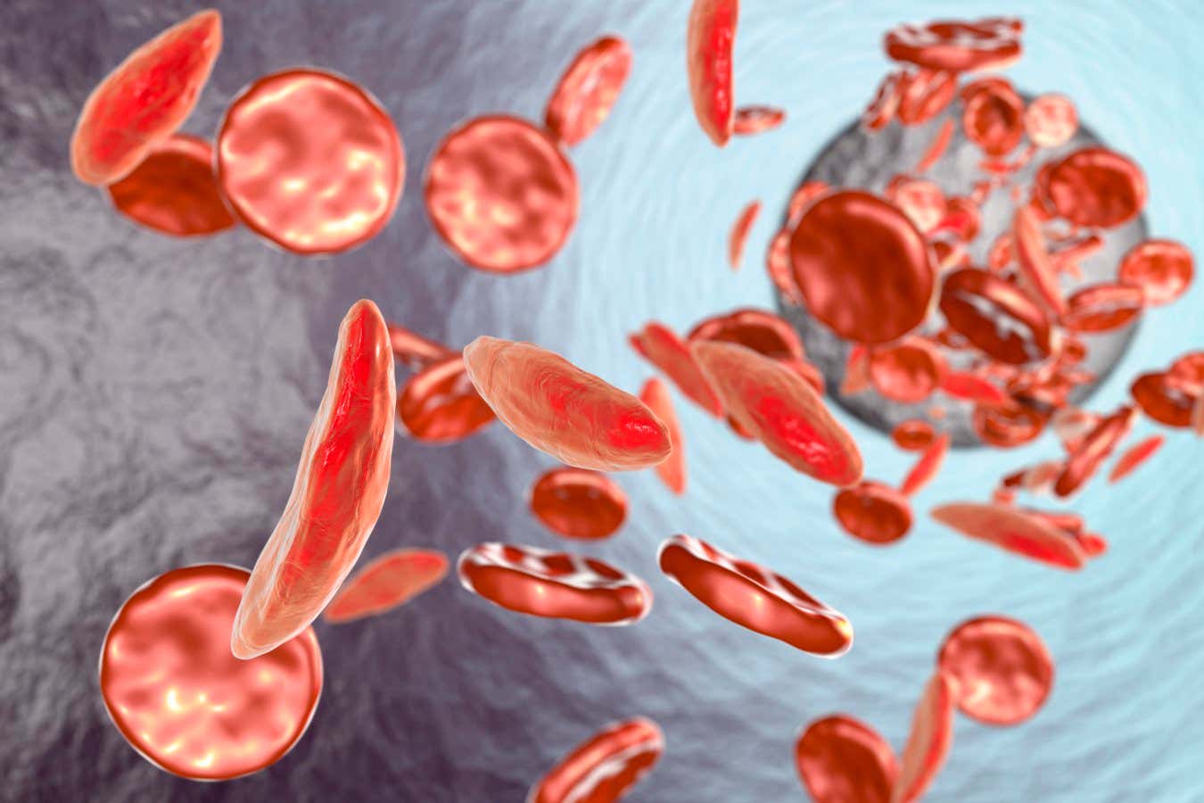 Sickle cell red blood cells