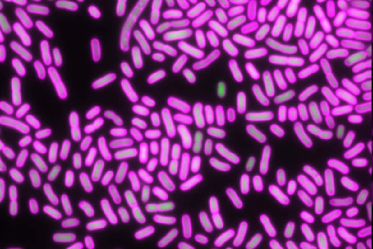 microscope images showing ciprofloxacin-resistant E. coli (credit: University of Oxford)