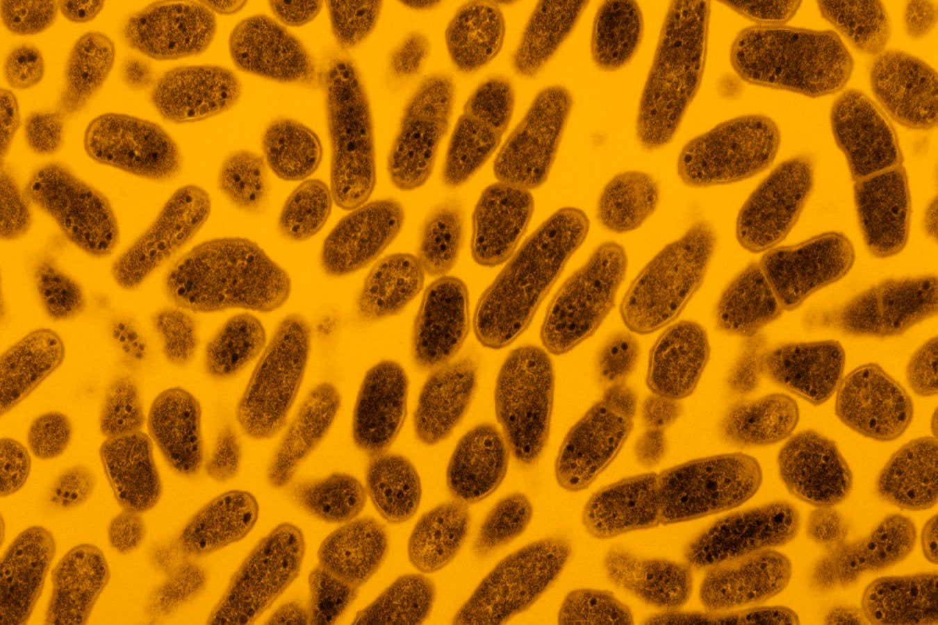 A transmission electron micrograph of a colony of Gardnerella vaginalis , bacteria that are found in vaginas and the urethras of men who have vaginal sex