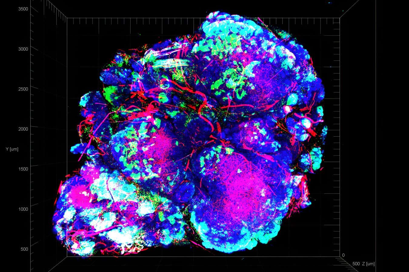 A breast cancer tumour in a mouse