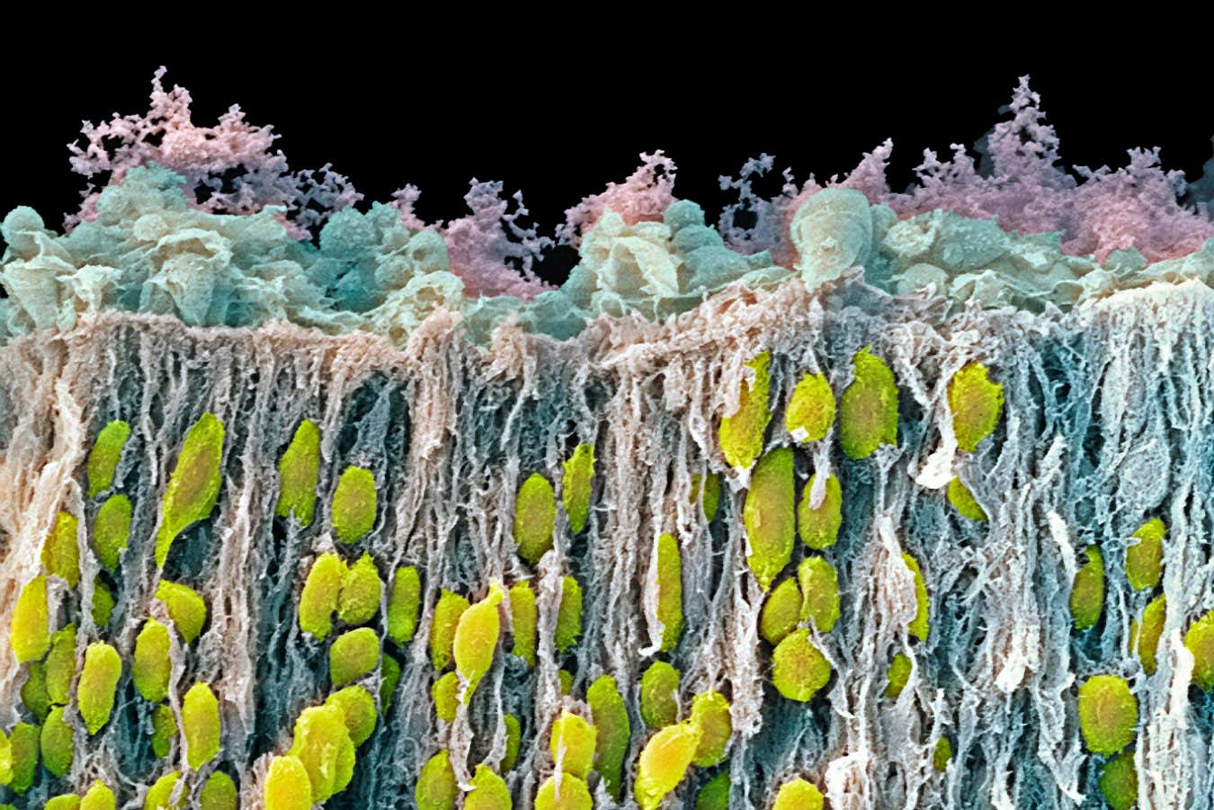 A scanning electron micrograph of neurons in the corpus striatum part of a foetal brain