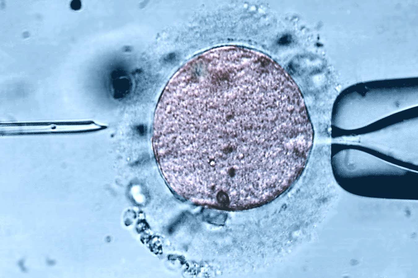 A light micrograph of a sperm cell being injected into an egg via an intracytoplasmic sperm injection (ICSI)