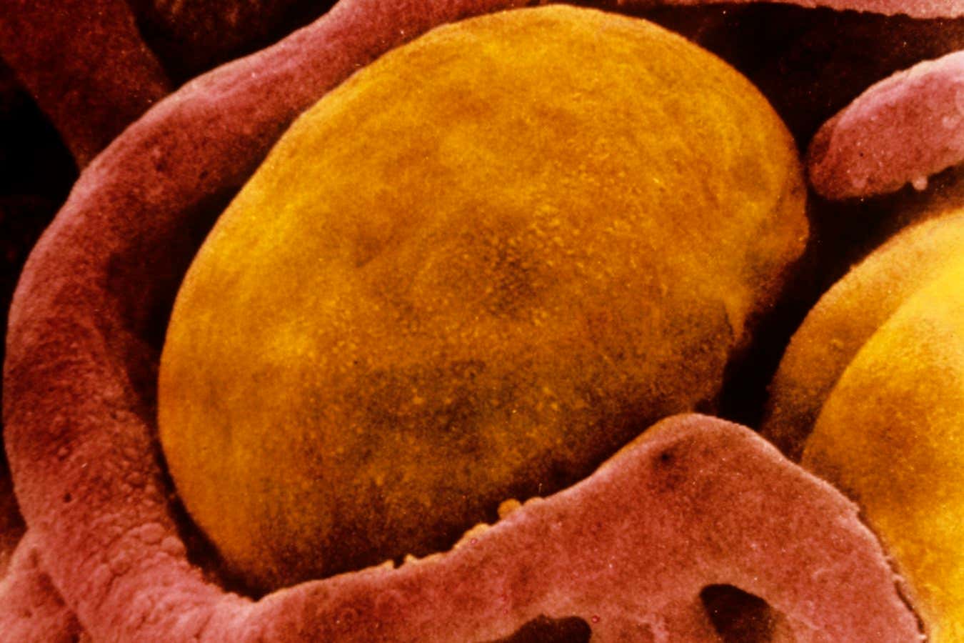 A scanning electron micrograph of a brown fat cell surrounded by capillaries