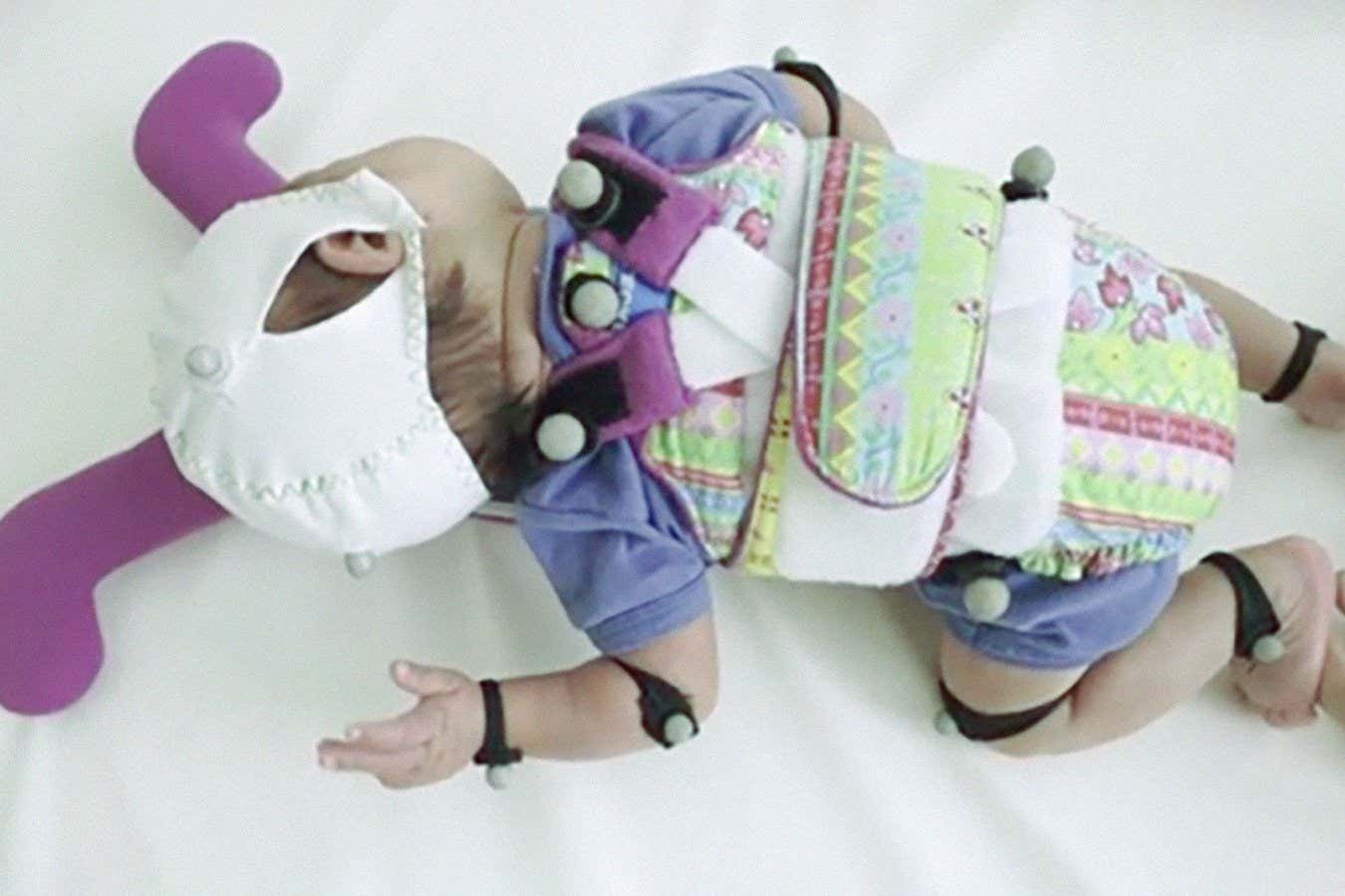 A very premature baby strapped onto the medical skateboard