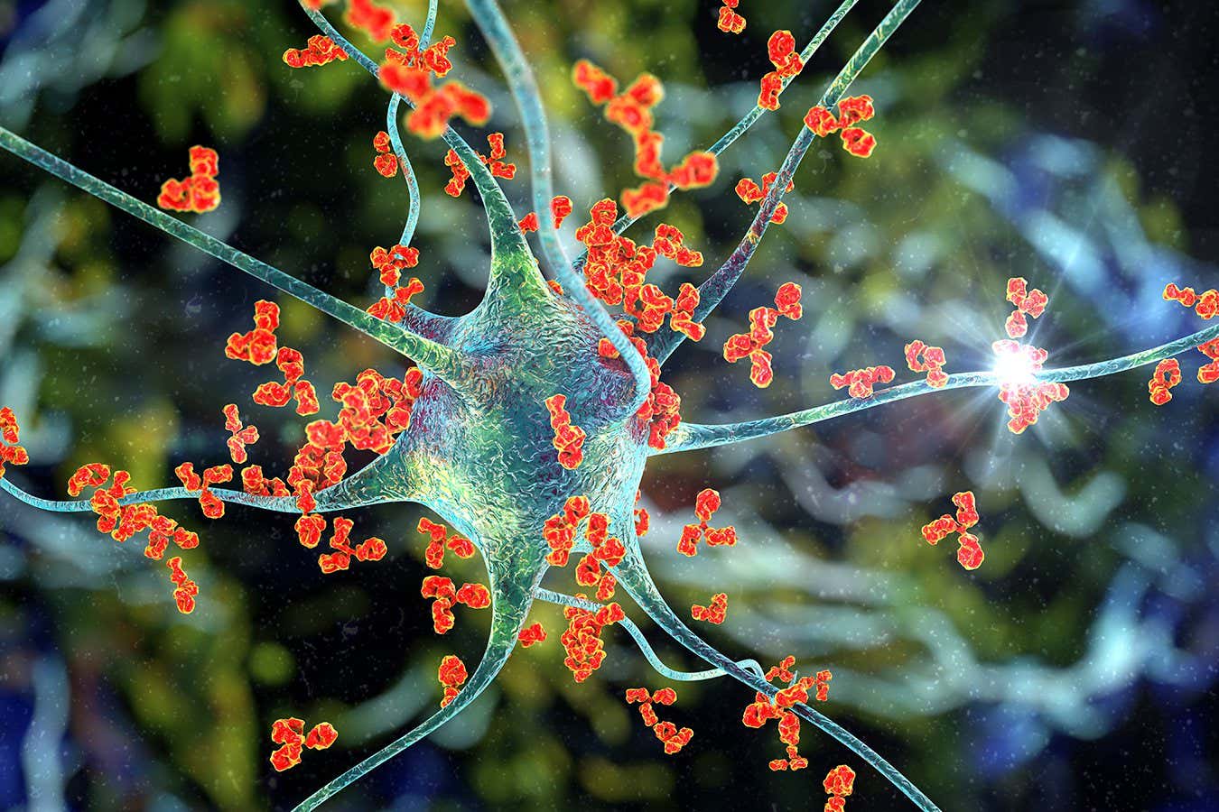 Many autoantibodies, shown as orange, triple lobed forms, surround and attack a much larger, pale, partially translucent nerve cell in a computer generated illustration
