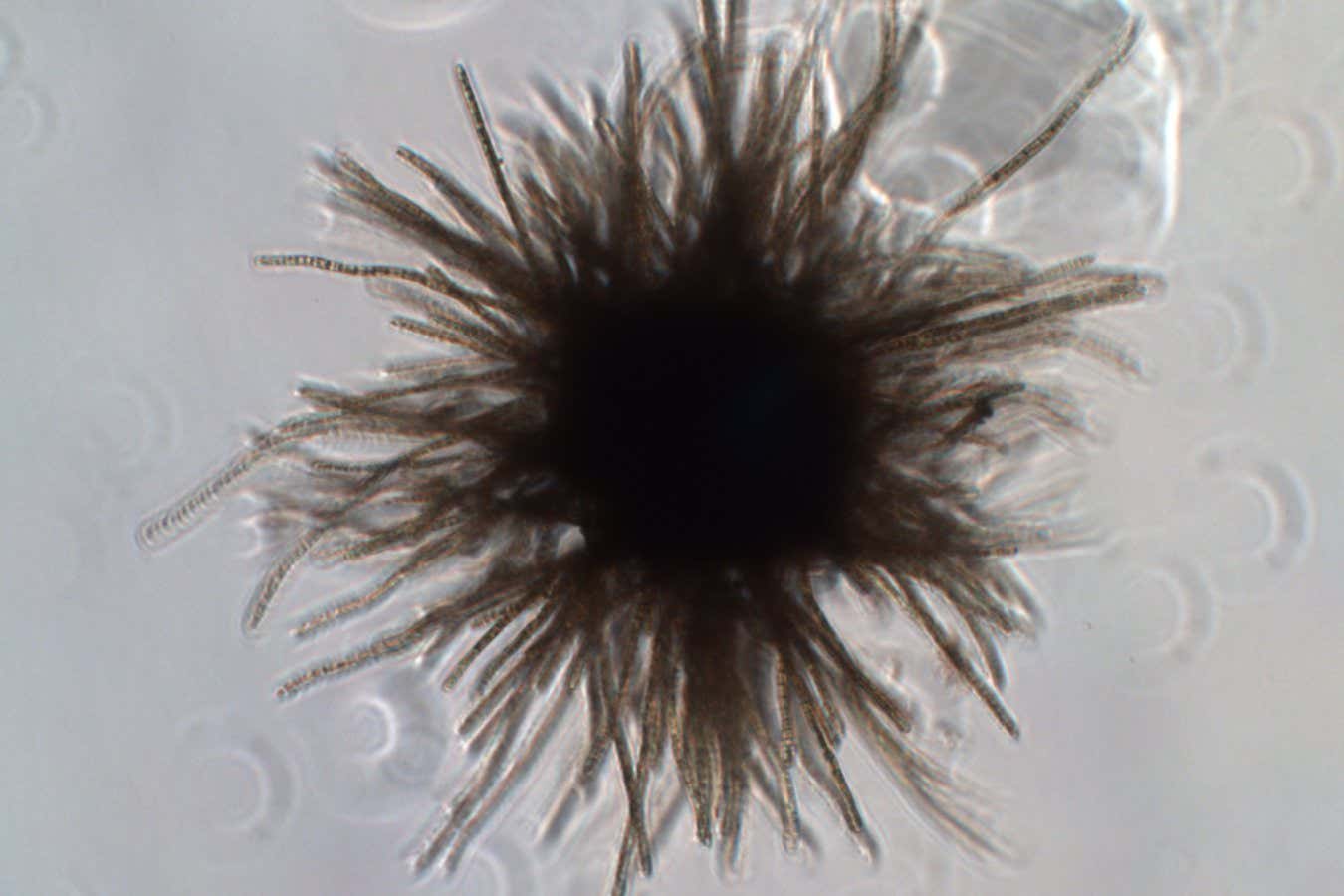 Trichodesmium thiebautii (light micrograph) Trichodesmium thiebautii is a cyanobacterium, or blue-green alga, that forms colonies of cells. In high concentrations, they create golden-brown surface mats, often referred to ?sea sawdust,? in the Gulf of Mexico. These large concentrations, called blooms, are sometimes associated with fish kills and can cause dermatitis or ?swimmer?s itch? when handled or contacted. When blooms die and decay, they can discolor the water pink to red. Toxin production by this species is being investigated. https://www.flickr.com/photos/myfwc/8678780050