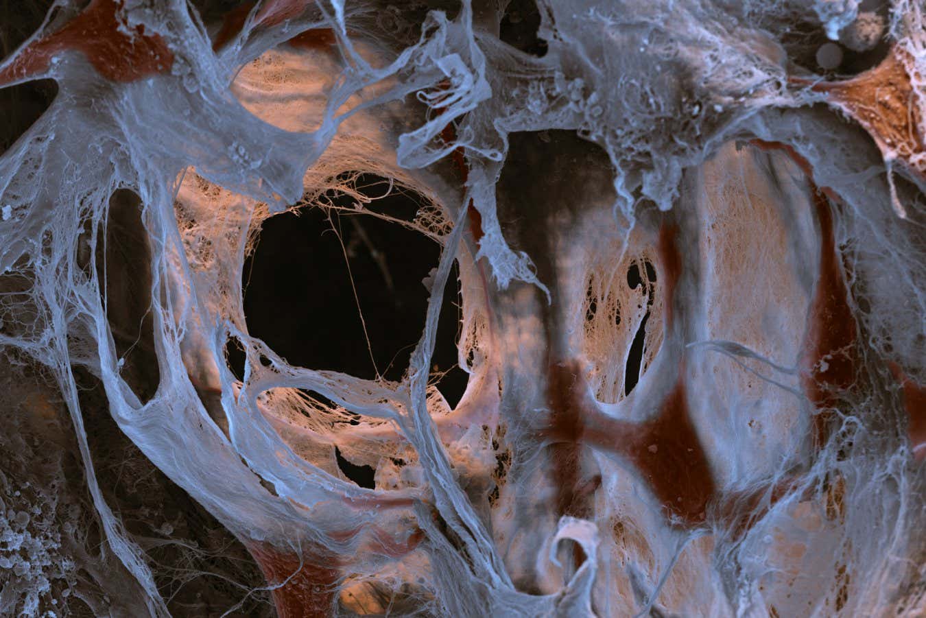 Scanning electron micrograph of mesenchymal stem cells, derived from an umbilical cord, grown in a gel culture