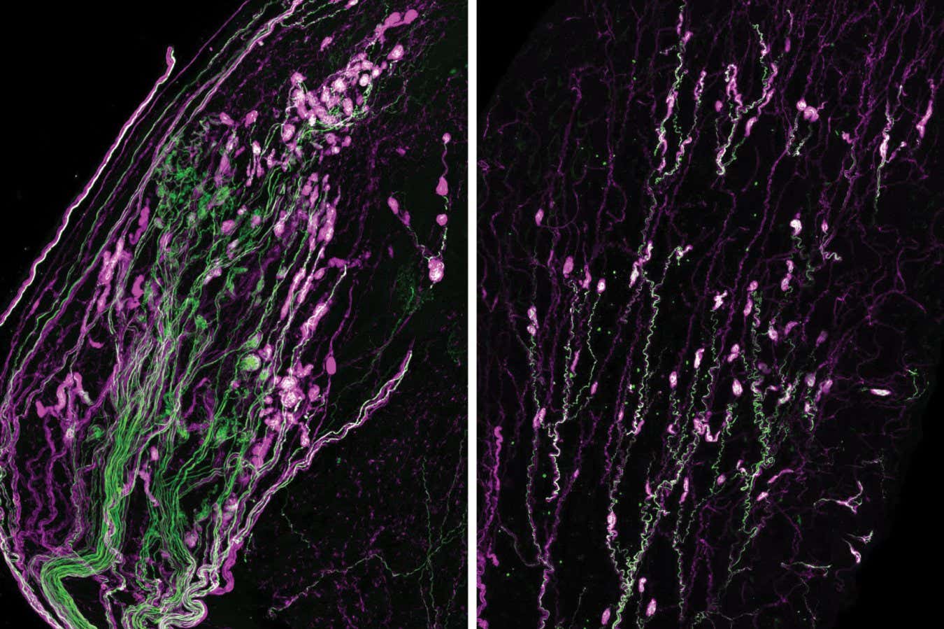 Microscope image of Krause corpuscles
