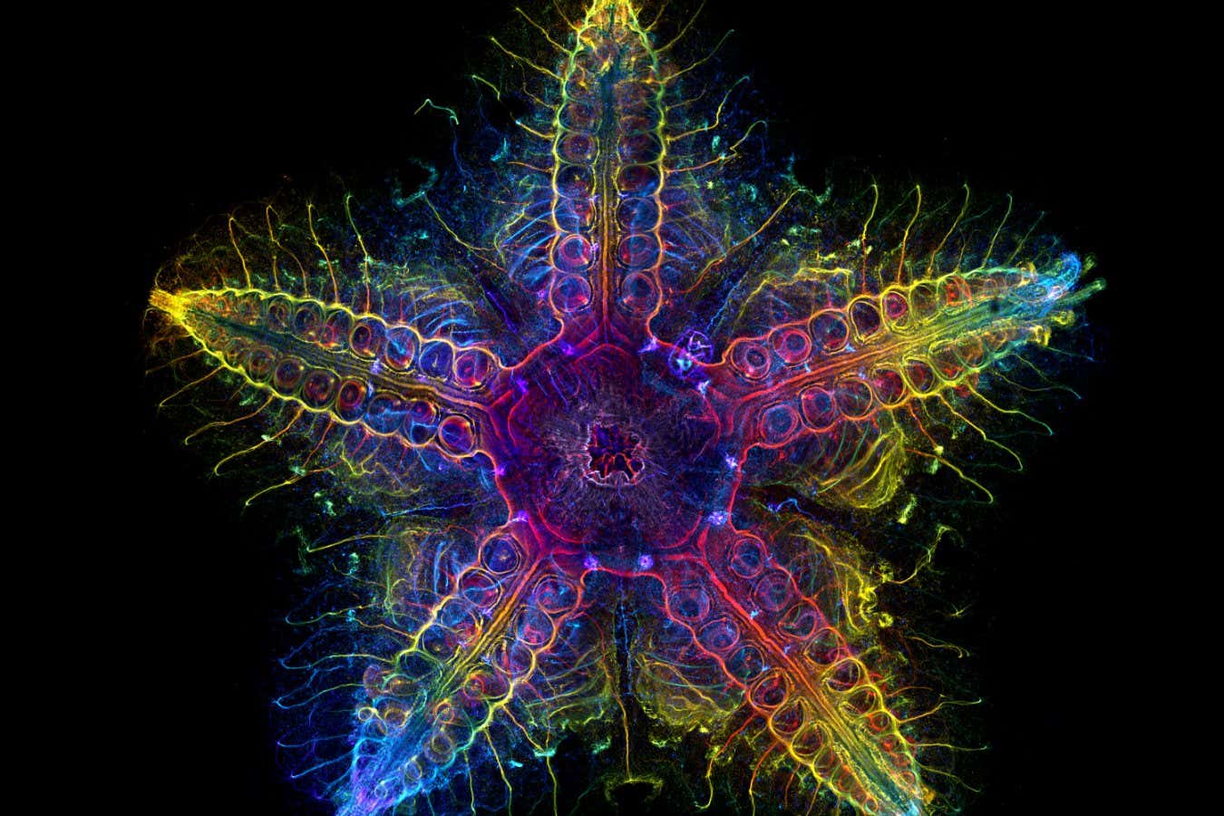 The Global Winner The global winning image was taken by Laurent Formery (USA). Nervous system of a juvenile sea star (Patiria miniata) about 1 cm wide. Labeled with an antibody against acetylated tubulin after optical clearing, and captured using a color-coded Z-projection.
