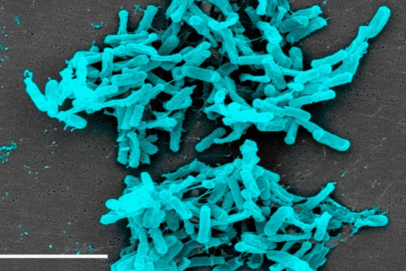The Clostridium difficile bacterium can cause diarrhoea - and shorter people may be particularly at risk