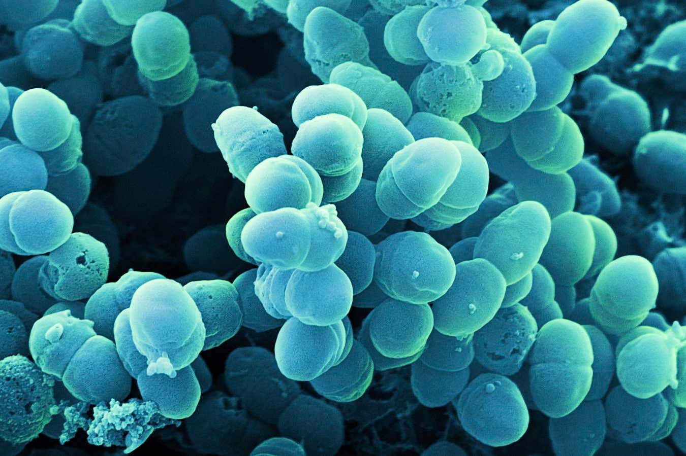 Levels of the bacteria Staphylococcus epidermidis may be higher in people with eczema than those without the condition