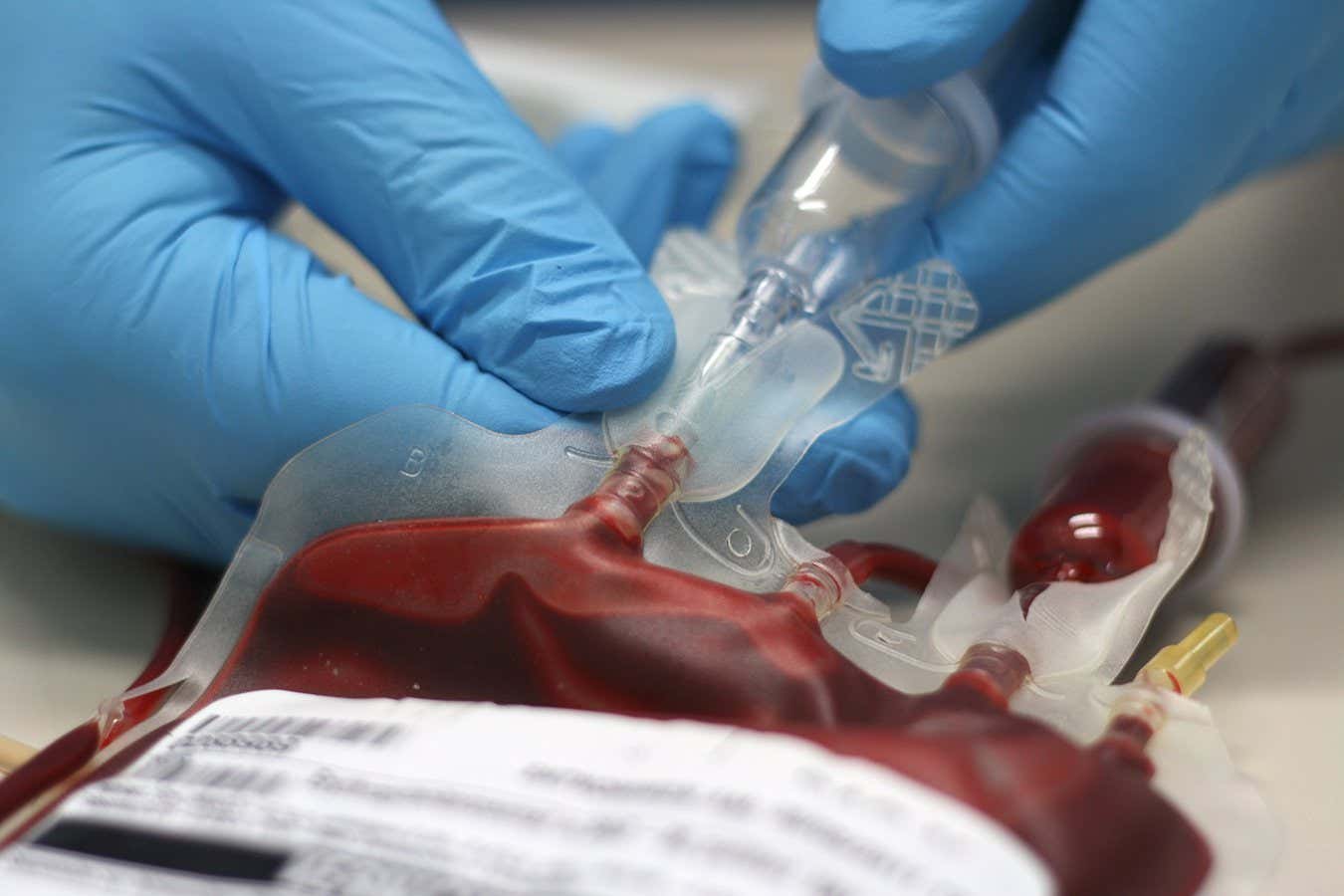 blood for a transfusion