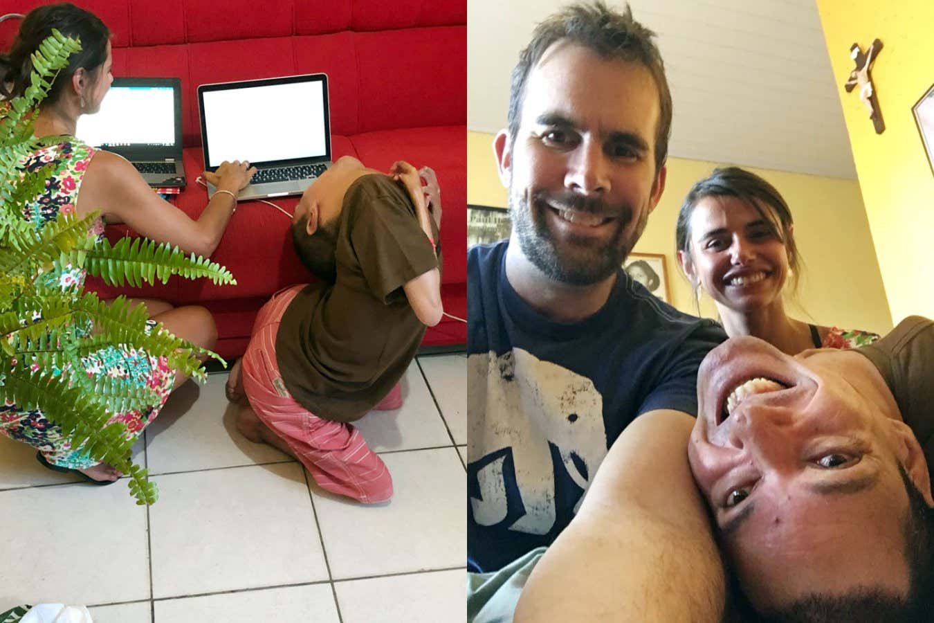 Claudio was born with a joint condition that restricted the range of motion in the joints of his neck