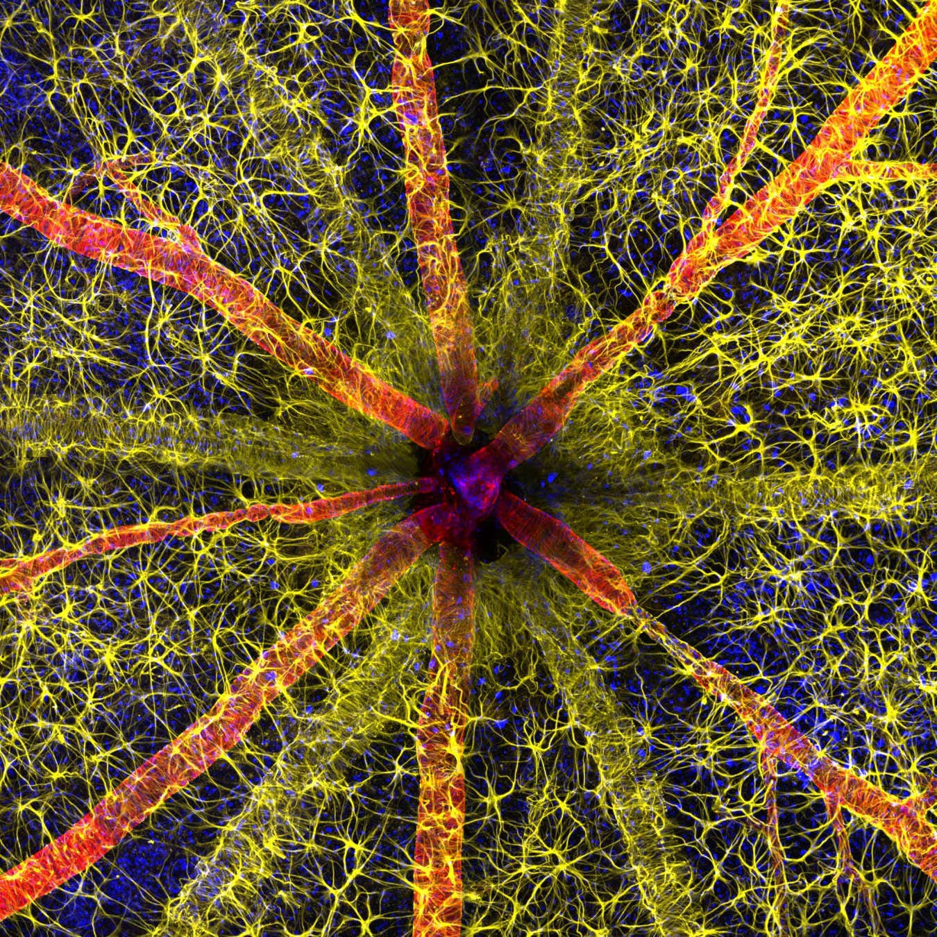 1st Place Hassanain Qambari & Jayden Dickson The Lions Eye Institute Department of Physiology & Pharmacology Perth, Western Australia, Australia Rodent optic nerve head showing astrocytes (yellow), contractile proteins (red) and retinal vasculature (green) Confocal, Fluorescence, Image Stacking 20X (Objective Lens Magnification)