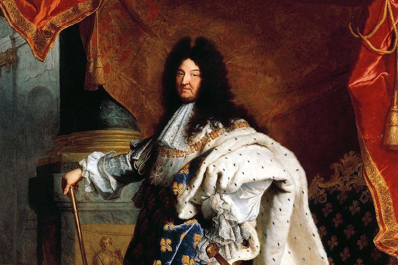 Louis XIV made a surprising type of surgery popular