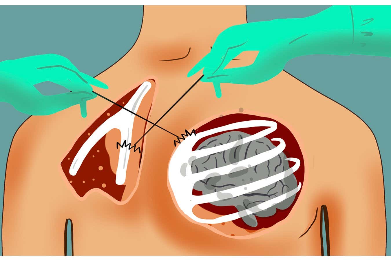 What could stop wrong-organ surgical errors? Being careful, says study